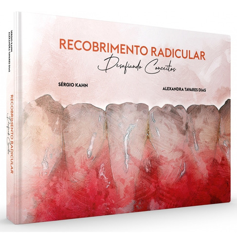 Livro Recobrimento Radicular - Desaf Conceitos - Sergio Kahn