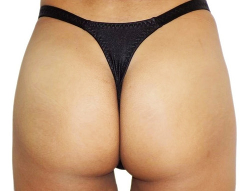 Noneca - Calcinha Aquendar Cirré - Trans, Cds, Travs, Drags