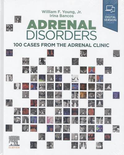 Libro Adrenal Disorders. 100 Cases From The Adrenal Clinic