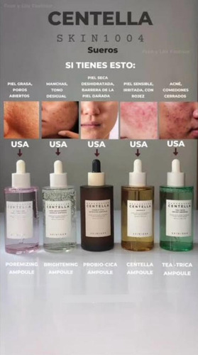 Skin1004 Ampoule Serum Centella Asiatica Madagascar 100ml Todo Tipo De Piel Día/noche