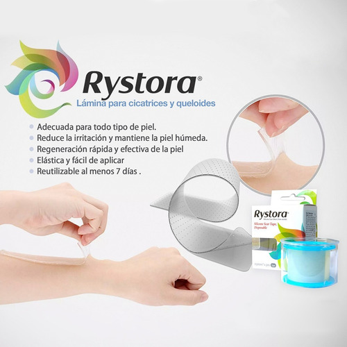 Imagen 4 de 6 de Rystora De Silicona En Rollo 2,5cm X 1,5mtrs Para Cicatrices