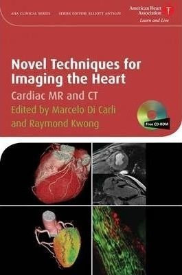 Novel Techniques For Imaging The Heart - Marcelo F. Di &-.