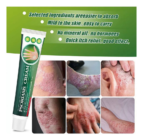 Mz D Crema Dermatofito Crema Dermatofítica Tópica Para Psori