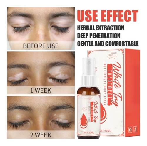 White Tag Spray Tratamiento Facial Corporal Vitiligo 50 Ml Neutra