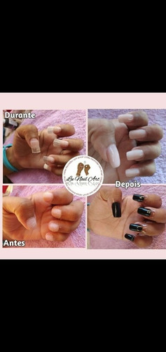 Imagem 5 de 5 de Estética