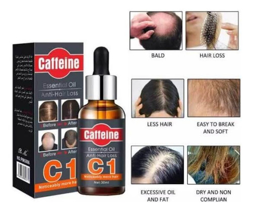 Serum Anticaida Calvicie Caffeina Gengibre Y Vitaminas 30ml