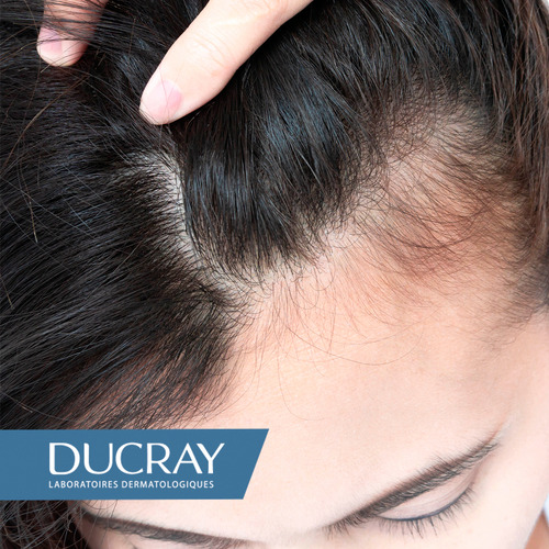 Ducray Creastim Reactiv Loción Anti-caída 60ml