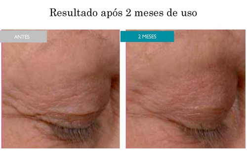 Sérum Para Área Dos Olhos  Recupell