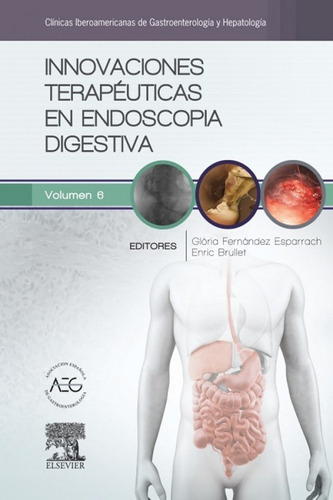 Cigh Innovaciones Terapéuticas En Endoscopia Digestiva!