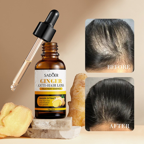 Kit De 3pzs. Serum Capilar De Jengibre Ant- Caída 30ml
