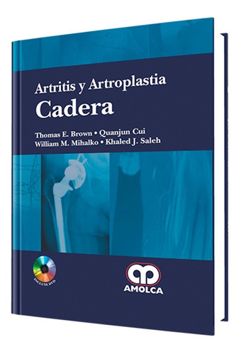 Artritis Y Artroplastía Cadera.