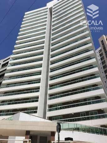 Imagem 1 de 30 de Apartamento Com 3 Quartos À Venda, 104 M², Área De Lazer,2 Vagas, Financia - Cocó - Fortaleza/ce - Ap0335