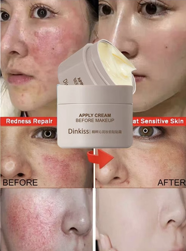 Crema Facial Reparadora Rosacea Hidratante Piel Sensible