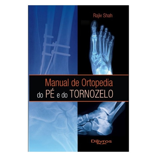 Manual De Ortopedia Do Pé E Do Tornozelo