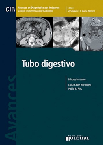 Cir Avances Diag.por Imágenes: Tubo Digestivo. Ros Mendoza