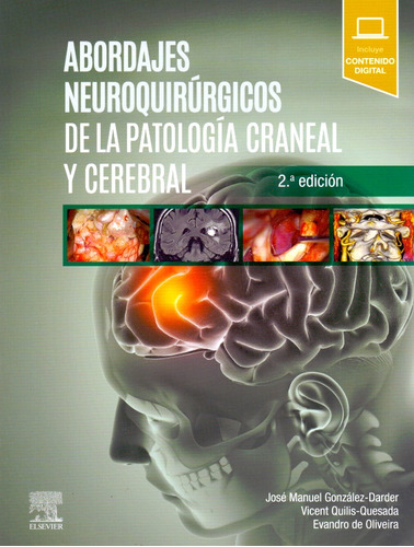 Abordajes Neuroquirúrgicos De La Patología Craneal Y Cerebra