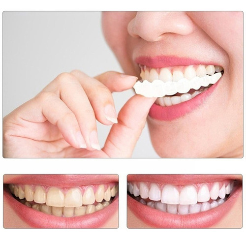 Soporte Provisional Para Una Dentadura Postiza