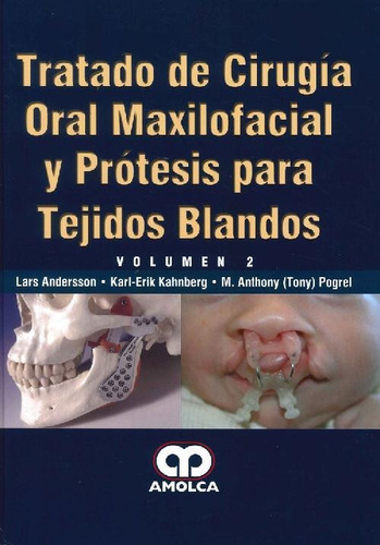 Libro Tratado De Cirugía Oral Maxilofacial Y Prótesis Para T