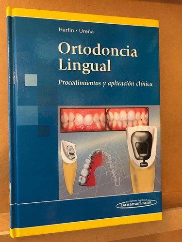 Ortodoncia Lingual