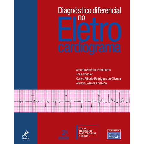 Diagnóstico diferencial no eletrocardiograma, de Friedmann, Antônio Américo. Editora Manole LTDA, capa dura em português, 2011