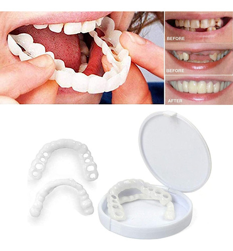 Dentaduras Postizas Instantáneas,carillas Dentales,carillas