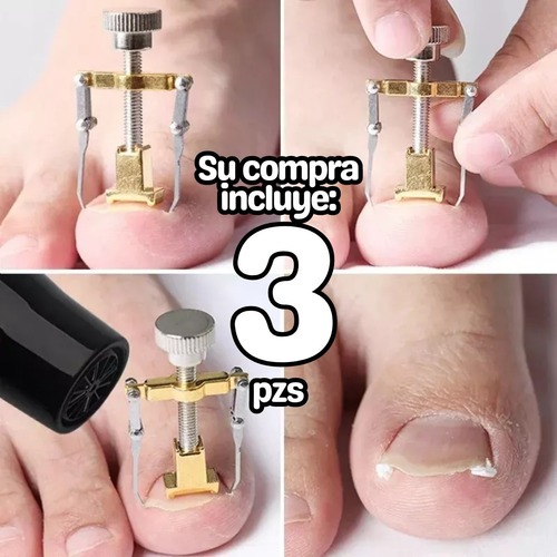 3pz Herramienta Para Sacar Uñas Enterradas Removedor Uñeros