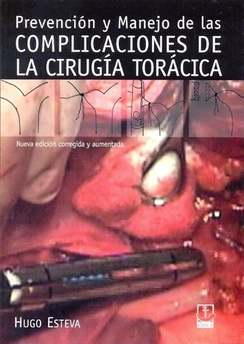 Prevencion Y Manejo De Lasplicaciones De La Ciru, De Esteva, Hugo. Editorial Educa En Español