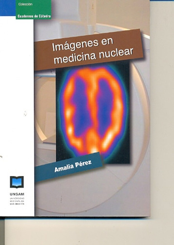 Imagenes En Medicina Nuclear - Amalia Perez