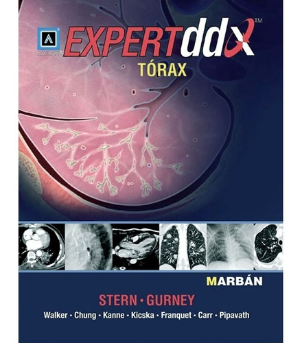 Tórax Expert Ddx Stern Gurney