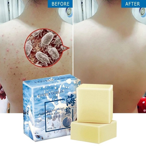 Imagem 5 de 5 de Sabonete Barra Acne Poros Espinha Oleosidade 60g Sal Marinho
