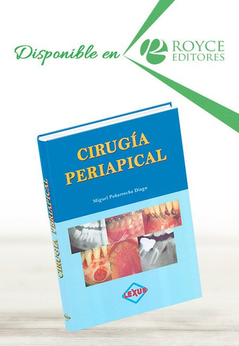 Cirugía Periapical