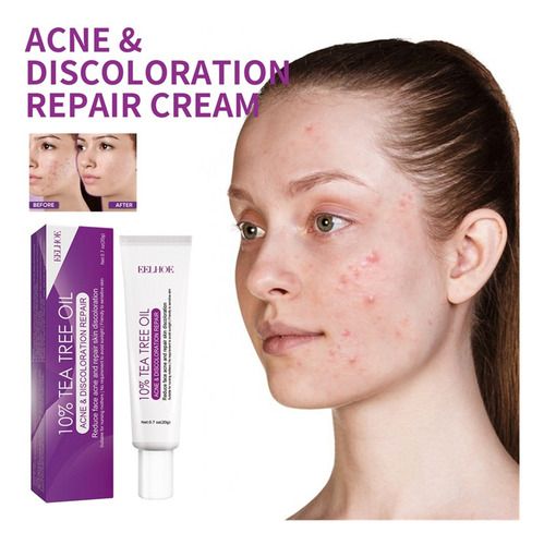 Crema X Azelaic, 10% Azelaic Booster Healing, Para Rostro Y