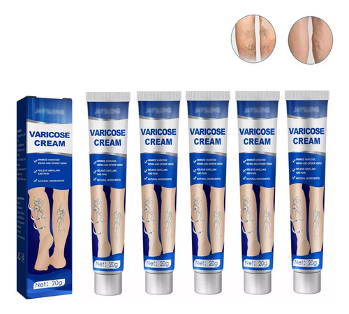 Poderosa Crema Eliminadora De Varices De - g a $906