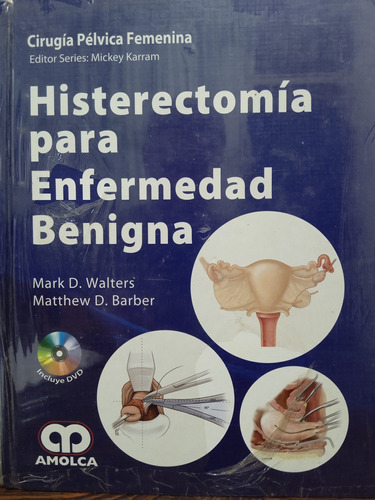 Histerectomía Para Enfermedad Benigna Amolca Walters
