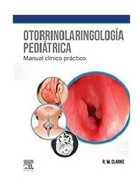 Clarke Otorrinolaringología Pediátrica. Manual Clínico