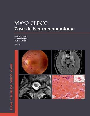 Libro Mayo Clinic Cases In Neuroimmunology - Andrew Mckeon