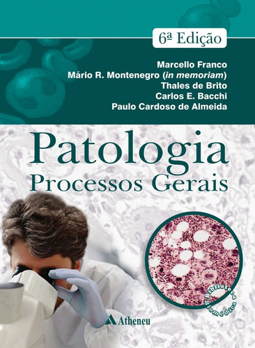 Patologia: processos gerais, de Franco, Marcello. Editora Atheneu Ltda, capa dura em português, 2015