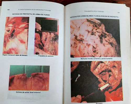 Elementos Básicos De Medicina Forense (Usado)