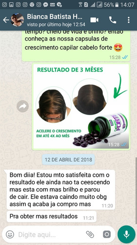 Imagem 7 de 9 de Melhor Produto Para Crescer O Cabelo Em 15 Dias Cresce