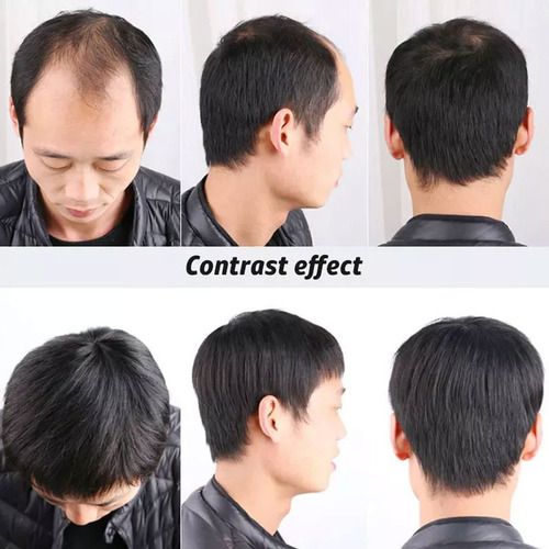 Conjunto De Pelucas De Los Hombres Con El Pelo Corto