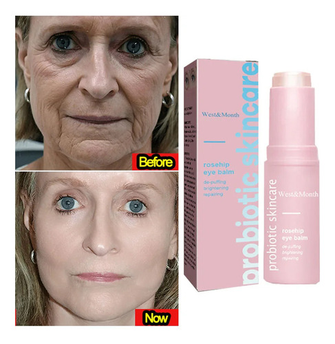Bálsamo Facial Multirebote Instantáneo Para Eliminar Arrugas