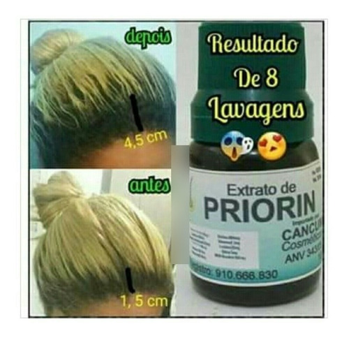 Shampoo Condicionador 2 Tônicos - Cresce Cabelo - Priorin