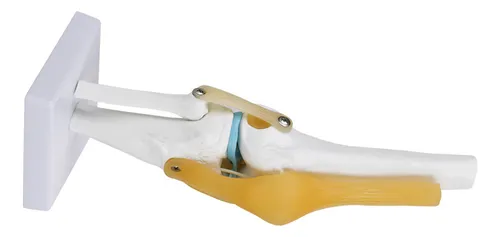 Knee Joint Model Anatomy Study Life Size Human For Skeleton