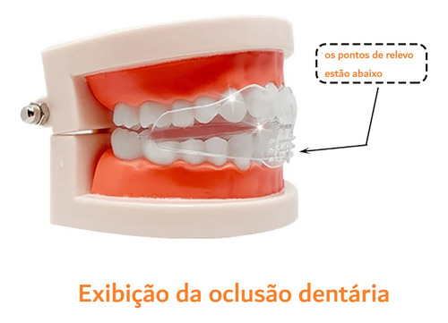 Kit 3x Placa Anti Ronco Bruxismo Alinhamento Dentes Adulto