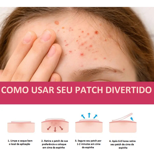 Adesivo Secante P/ Espinhas Acne - 5 Modelos C/ 144 Adesivos