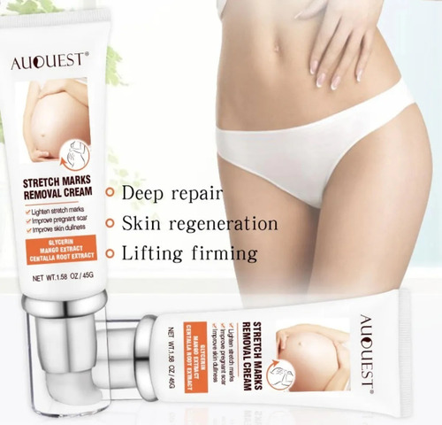 Creme Anti Estrias Stretch Marks Removal