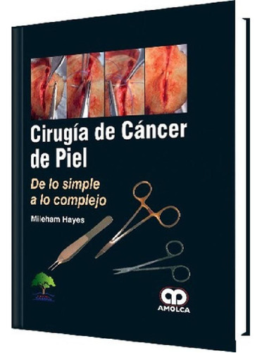 Libro - Cirugía De Cáncer De Piel De Lo Simple A Loplejo