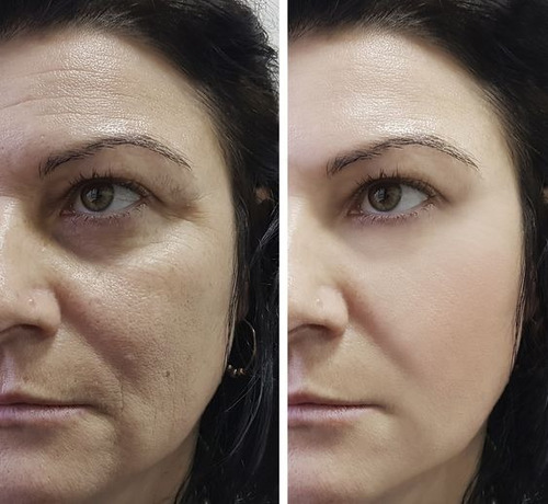 Crema Anti-age/retinol/ácido Hialurónico/+ 6 Aceites Puros