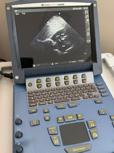 Ecocardiograma Portátil Setorial Transcraniano Sonosite (Usado)