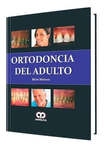 Ortodoncia Del Adulto.